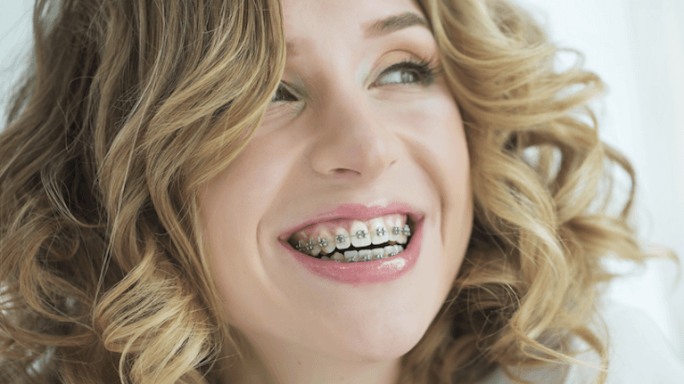 pre-teen with braces thinking about oral hygiene tips in highlands ranch